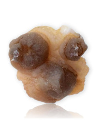 Calcédoine noire Botryoïdale